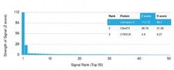 Cathepsin K, Mouse anti-Human, Clone: CTSK/2792, Novus Biologicals 20 ug;